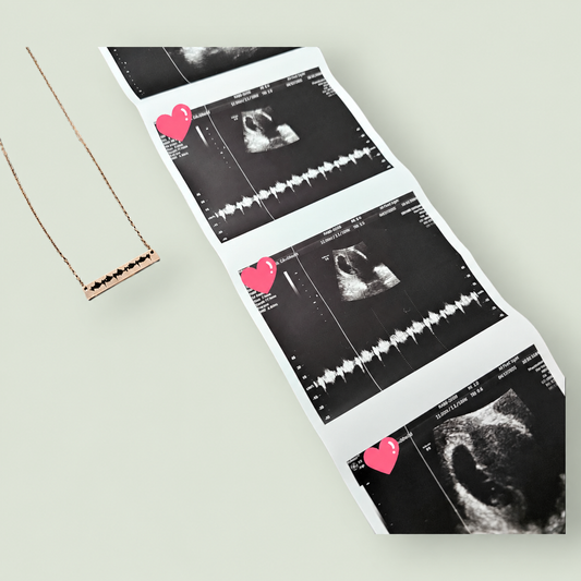 Gold heartbeat bar necklace displayed with an ultrasound photograph on soft sage.